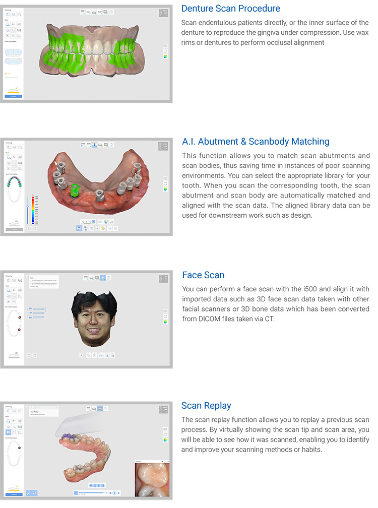 i500 Intraoral Scanner
